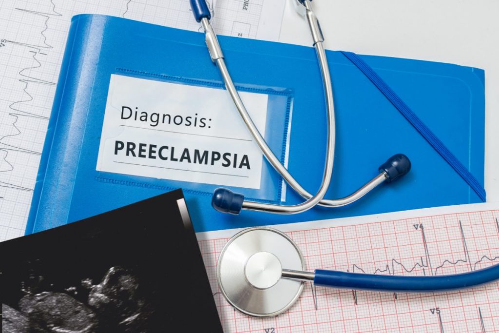 embarazo de alto riesgo: preeclampsia